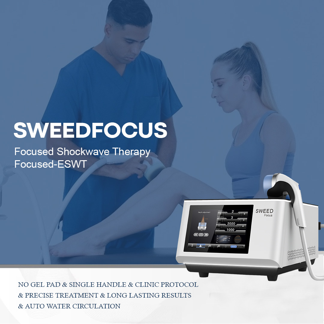 SWEED FOCUS